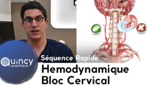 Hemodynamique bloc cervical